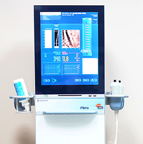 Equipo de Fibroscan con tecnología CAP